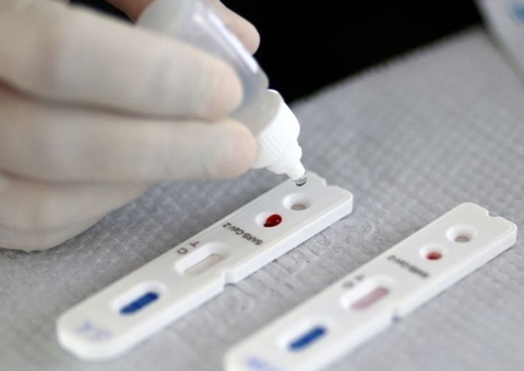 Amazonas registra um óbito e 52 novos casos de Covid-19 em 24h