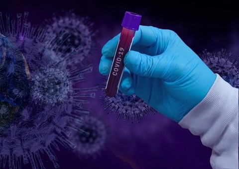 Sem mortes, Amazonas registra 723 novos casos de Covid-19 em 24h