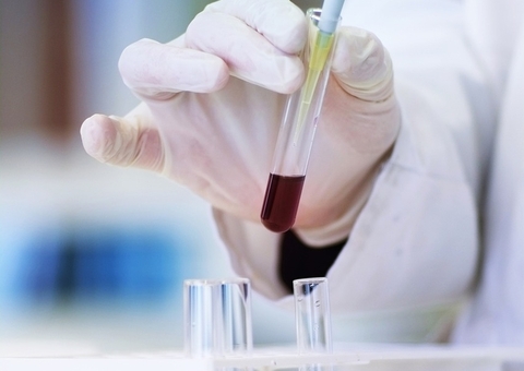 Nova variante do HIV é descoberta no Brasil