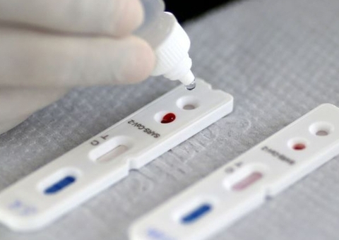 Amazonas registra 101 novos casos de Covid-19 em 24h