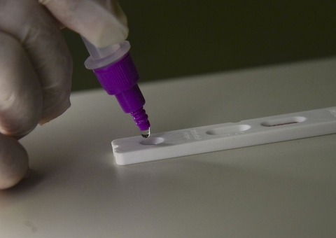 Amazonas registra 103 novos casos de Covid em 24h