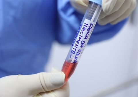 Brasil registra 17 mil casos de Covid-19 em 24h