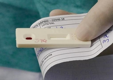 Por falta de dados, Anvisa adia decisão sobre liberação do autoteste de covid