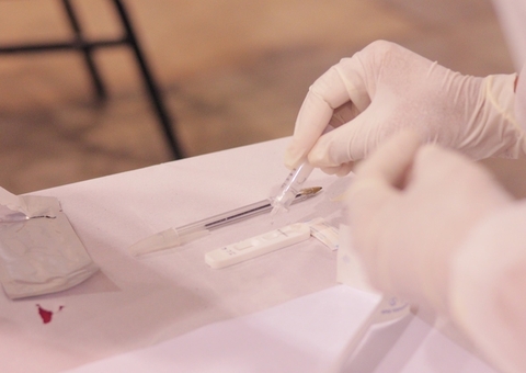 Cientistas estudam paciente que testa positivo para covid há mais de 1 ano