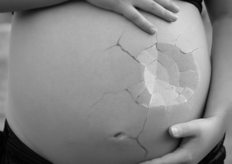 SUS registra mais de 53 mil casos de aborto no Amazonas