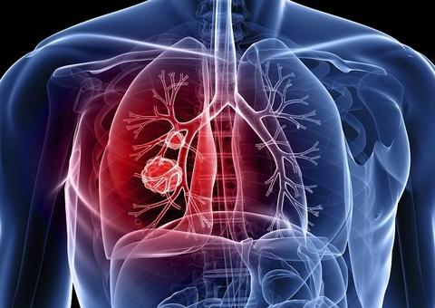 FVS lança campanha de combate à Tuberculose no Amazonas