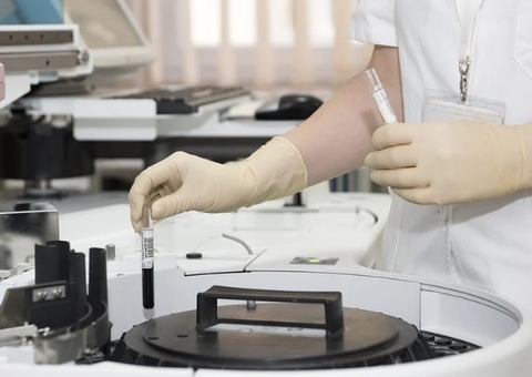 Adolescente que contraiu raiva morre no Distrito Federal