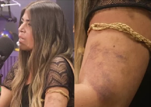 Bruna Surfistinha denuncia agressão do ex e mostra hematomas; medida protetiva é concedida 