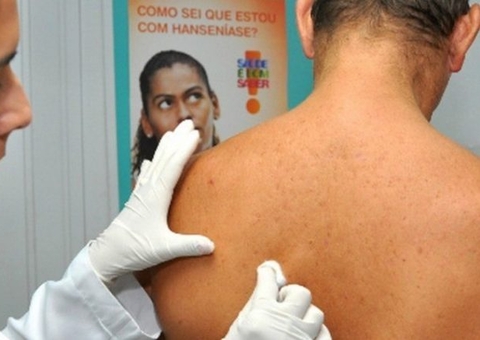 Lei que reajusta pensão de hansenianos é sancionada no Amazonas