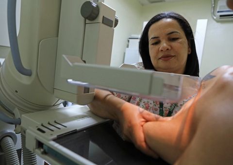 Mitos e verdades sobre a mamografia