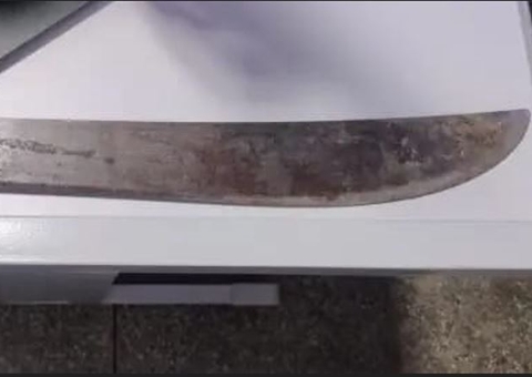 Adolescente tenta matar rival a terçadadas no Amazonas; vítima teve dedo decepado