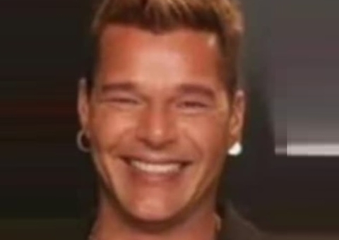 Ricky Martin mostra rosto desinchado após suspeita de harmonização facial: 'alergia'