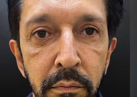 Prefeito de São Paulo Ricardo Nunes faz harmonização facial e mostra resultado