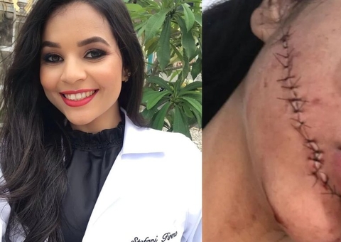 Vídeo mostra suspeita se aproximando de jovem que teve rosto cortado em ônibus