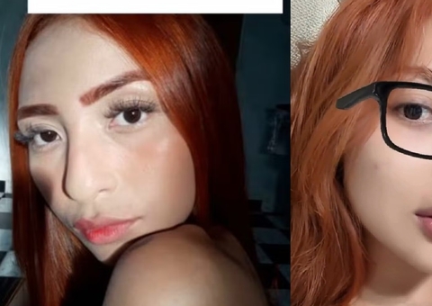 Ruivinha de Marte muda nariz e comenta resultado de procedimentos