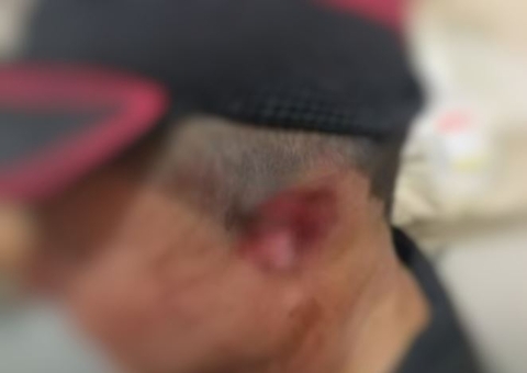 Casal indígena tem orelhas cortadas por membros de facção em Parintins