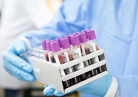 Biópsia líquida revoluciona diagnóstico precoce do câncer que vitimou Preta Gil