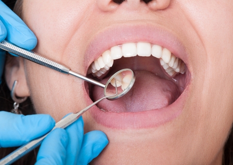 Quem já teve covid-19 deve redobrar cuidados com saúde bucal