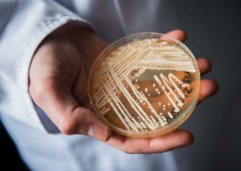 Três casos de superfungo Candidas auris é confirmada no Brasil