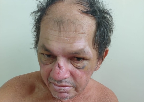 Hospital pede ajuda para localizar familiares de homem atropelado em Manaus