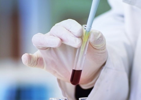 Cientistas anunciam 7º caso de cura do HIV