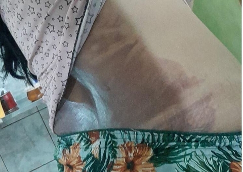 Homem joga água quente no corpo da esposa com filha no colo em Manaus