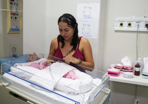 Gêmeas siamesas nascidas em maternidade de Manaus passarão por cirurgia de separação