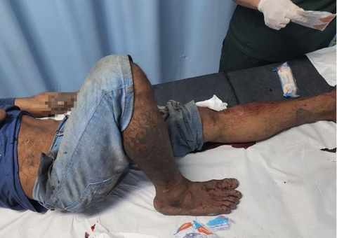 Homem é baleado e espancado com barra de ferro em feira de Manaus