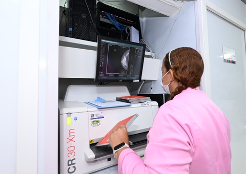 Confira locais de atendimento das Unidades Móveis de Saúde da Mulher em Manaus