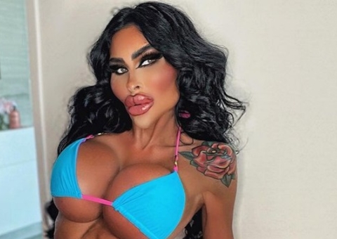 ‘Barbie Australiana’ já gastou mais de R$ 1 milhão em procedimentos estéticos