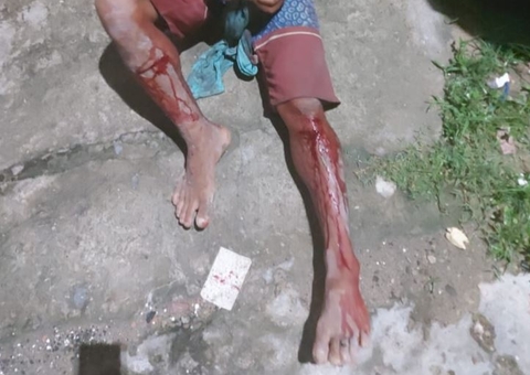 Homem é sequestrado e torturado no quintal de casa em Manaus