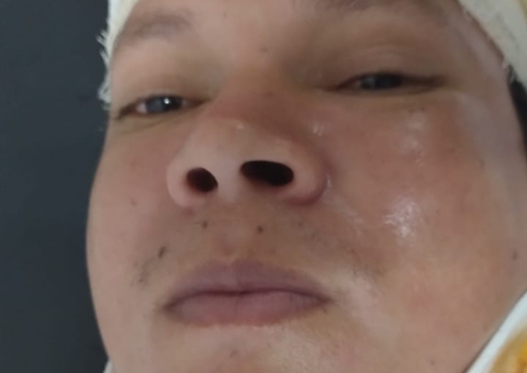 Hospital procura família de paciente atropelado em Manaus