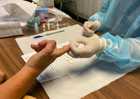 Amazonas registra 21 óbitos e 105 casos de hepatite; saiba como prevenir doença