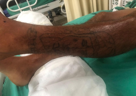 Hospital de Manaus pede ajuda para localizar família de paciente inconsciente em UTI