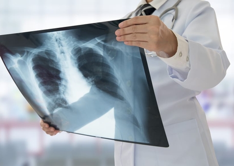 Amazonas registra aumento de casos de doenças respiratórias em dois meses