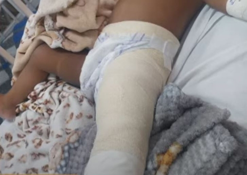 Bebê de 1 ano é baleada durante perseguição policial em Fonte Boa