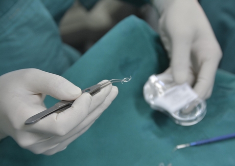 Amazonas terá mutirão de cirurgias de catarata