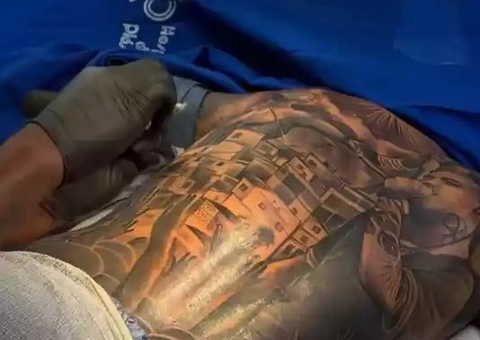 CFM proíbe uso de anestesia geral e sedação em procedimentos de tatuagem