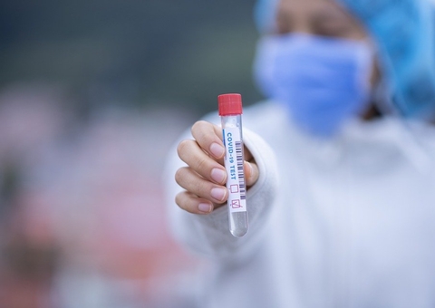 Brasil bate marca de 17 milhões de casos de Covid; 52.911 em 24hs