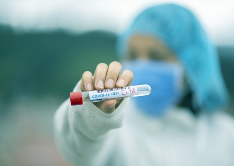 Às vésperas das festas de fim de ano, casos de covid-19 aumentam 64% no Amazonas