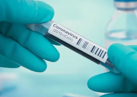 Covid: Pesquisa do Ministério da Saúde vai testar anticorpos de brasileiros