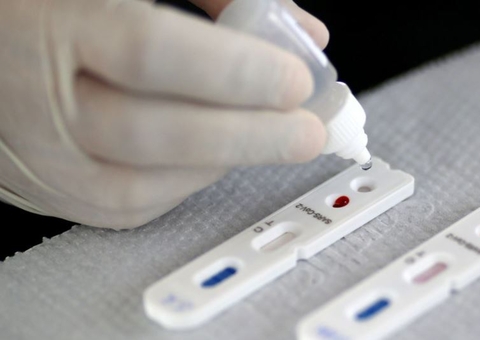 Amazonas registra 265 novos casos de Covid em 24h 