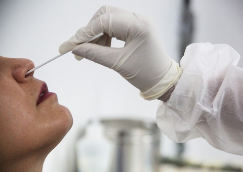  TCU manda governo usar testes de Covid prestes a vencer