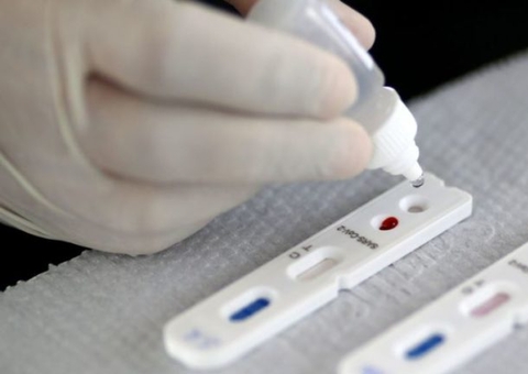 Teste de Covid pode ser declarado no Imposto de Renda 2021