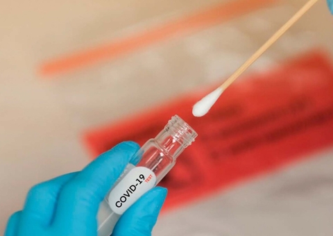 Em 24 horas, Brasil registra 76.692 casos e 2.494 mortes por Coronavírus