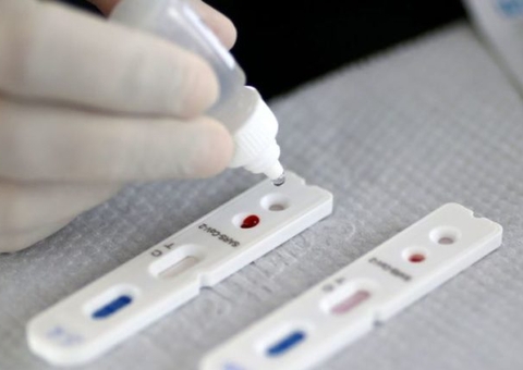 Brasil tem 2,9 mil mortes e 95,3 mil casos de Covid em 24 horas