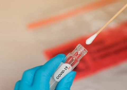 Brasil registra 2.978 novos casos de covid-19 e 34 mortes