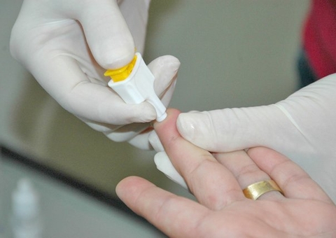 Manaus registra 70 casos de hepatites virais no primeiro semestre deste ano