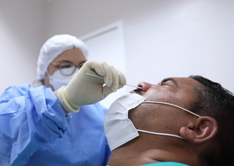 Amazonas registra 34 novos casos de Covid em 24h