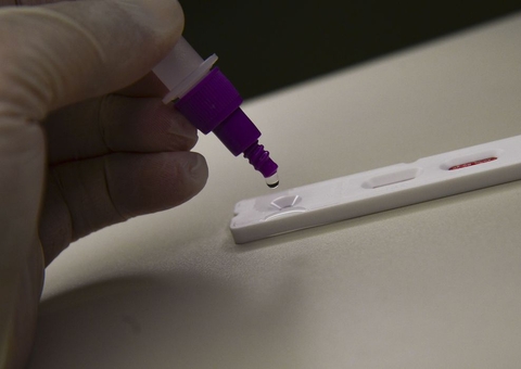 Fiocruz: casos de síndrome respiratória grave atingem patamar estável